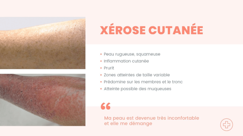 Oncologie 1 - Epitop Pharmacie