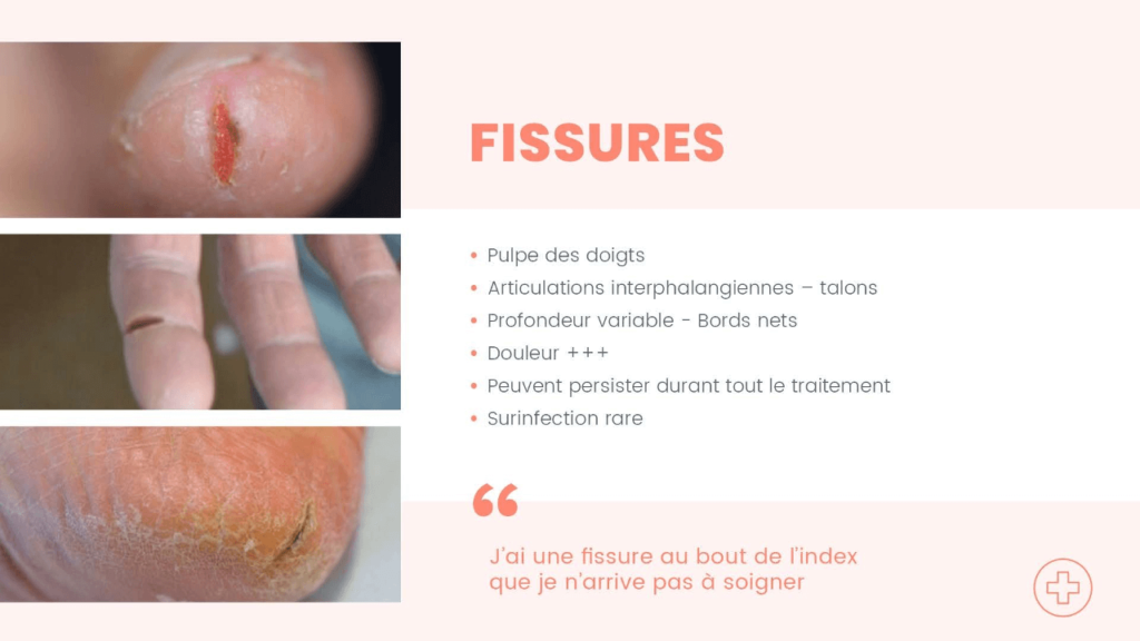 Oncologie 16 - Epitop Pharmacie