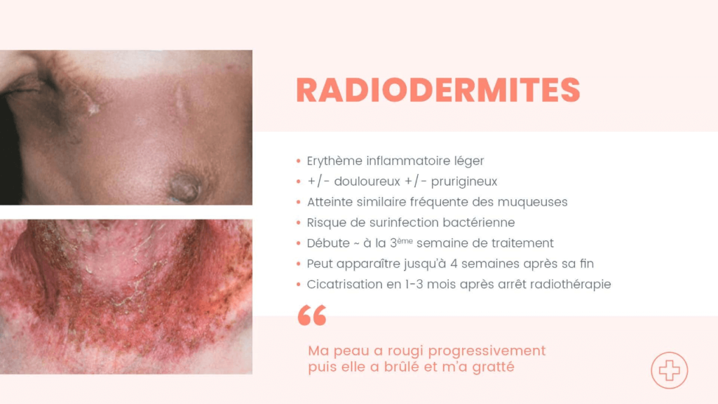 Oncologie 19 - Epitop Pharmacie