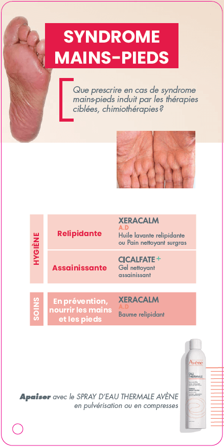 Syndrome Mains Pieds